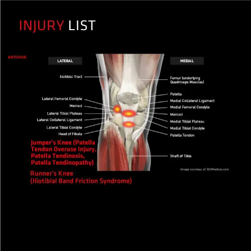 Thermoskin Dynamic Targeted Compression Knee Stabiliser (1 Unit)